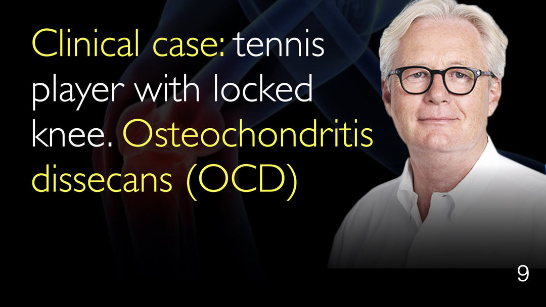 Kliininen tapaus: Tennispelaaja lukkiutuneella polvella. Osteochondritis dissecans (OCD). Ikä: 9.
